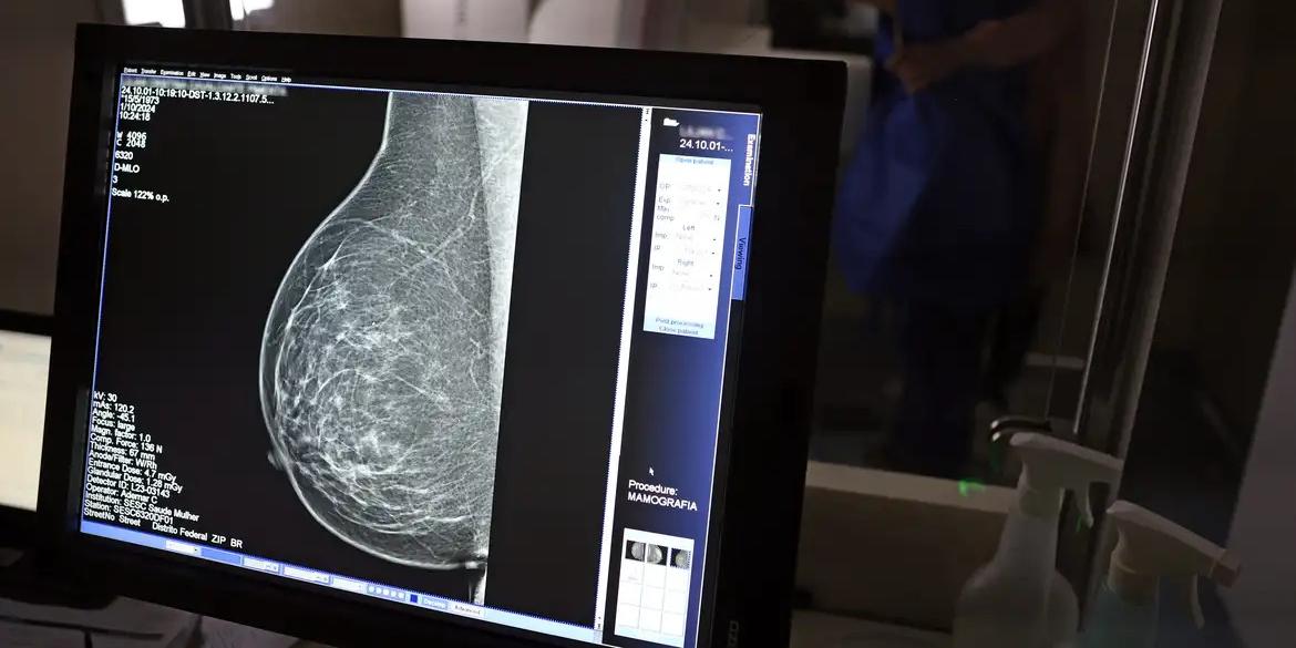 Rastreamento precoce reduz mortalidade por câncer de mama em até 30% (José Cruz/Agência Brasil)
