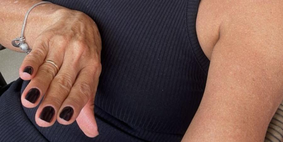 A médica Oriana Vieira Carneiro diz que já estava disposta a abrir mão da esmaltação em gel. “É prático e eu uso há dois anos. Mas já estava disposta a abandonar o método” (Arquivo pessoal)