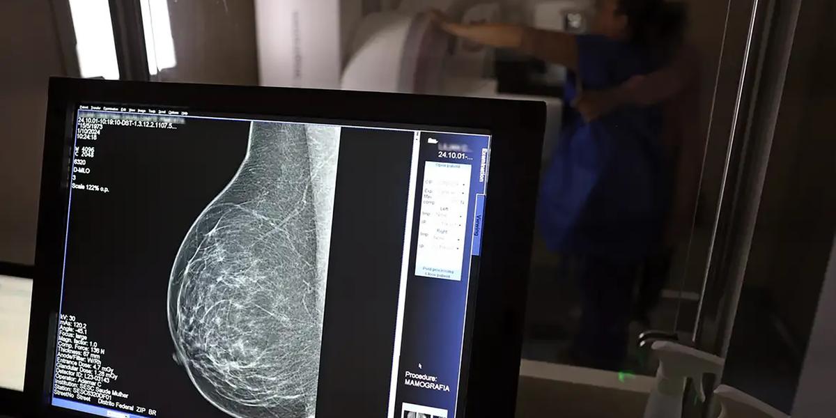 Fisioterapia é fundamental para que o paciente possa ter uma melhor reabilitação 