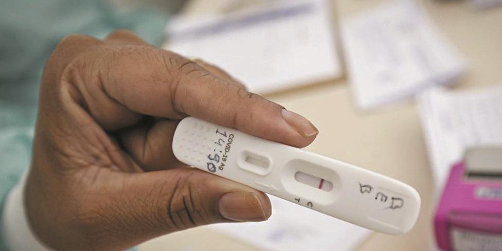 ORIENTAÇÕES - O teste deve ser realizado entre o primeiro e o sétimo dia do início dos sintomas ou cinco dias após contato com pessoa infectada pelo novo coronavírus (breno esaki/agência saúde df/divulgação)