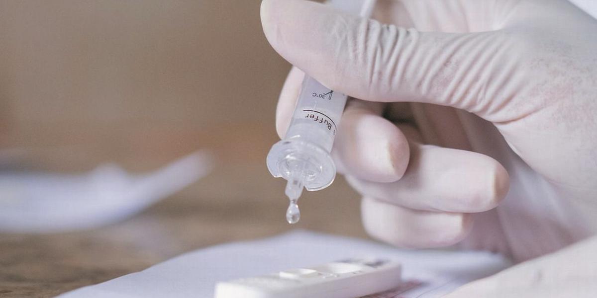 MAIS UM – Empresa já dispõe dos insumos necessários para produzir o autoteste, que vai detectar o coronavírus em 15 minutos (myke sena/ms/divulgação)