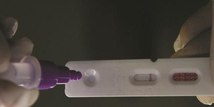 Nas últimas 24 horas, foram 15 mil notificações de Covid-19 no Estado: apesar da alta significativa, casos são de menor gravidade (MARCELLO CASAL JR./AGÊNCIA BRASIL)