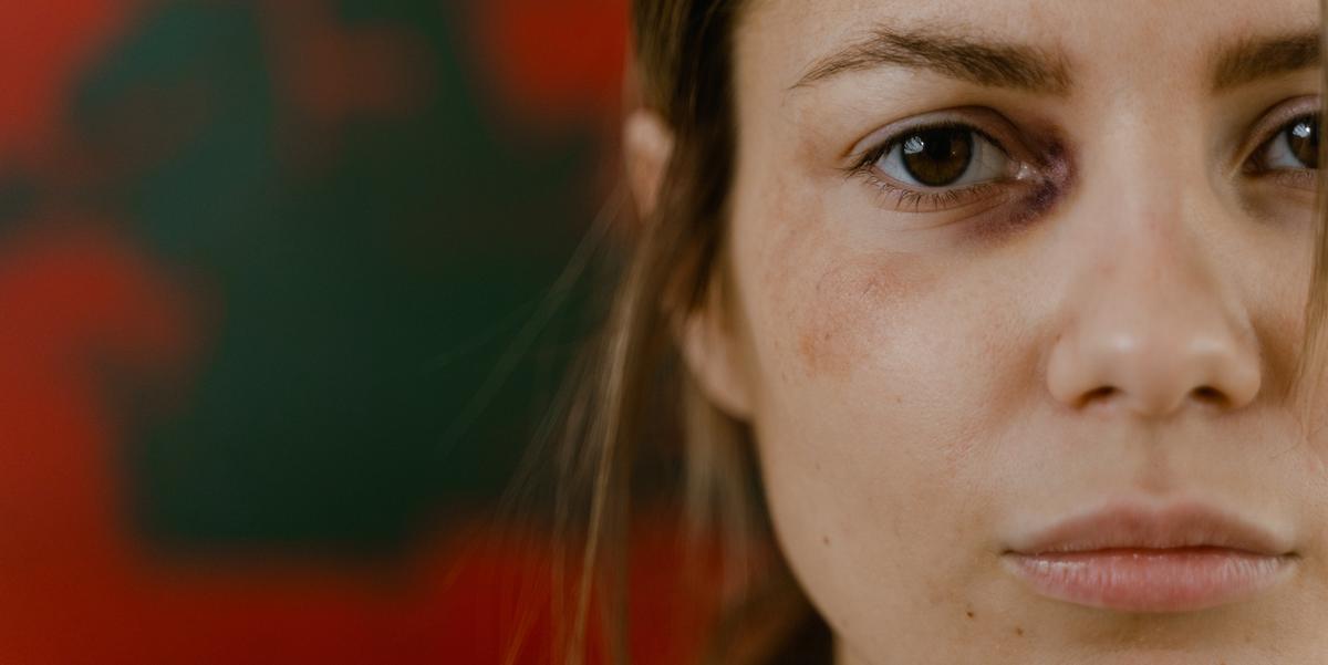 Para delegada, mulheres precisam entender que existe um limite para serem doces e compreensíveis (PEXELS)