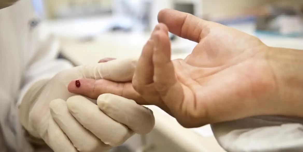 Em Minas, foram notificados 3.601 casos de HIV/AIDS até novembro de 2023 (AGÊNCIA BRASIL)